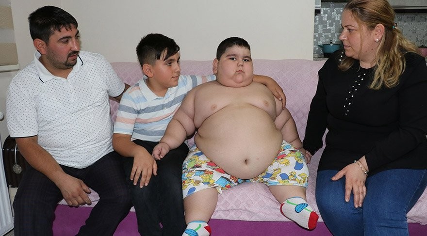 4 yaşlı uşaq 70 kiloqrama çatdı - FOTO