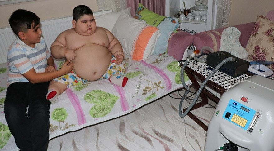 4 yaşlı uşaq 70 kiloqrama çatdı - FOTO