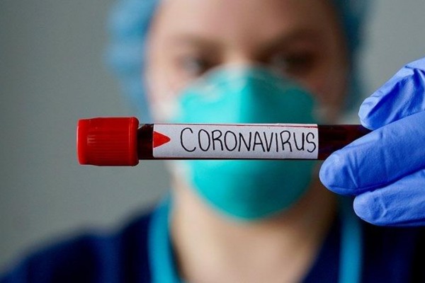 Azərbaycanda daha 38 nəfərdə koronavirus aşkarlandı 