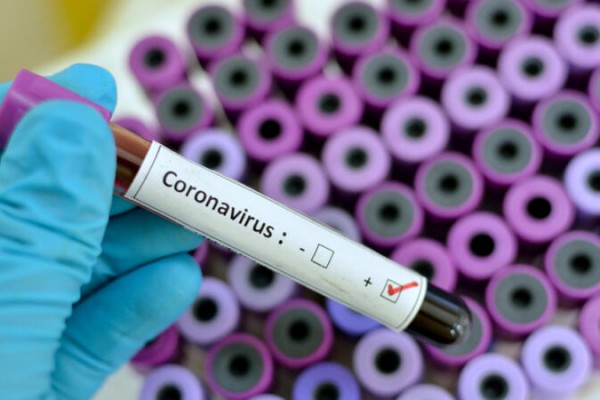 279 nəfər koronavirusa yoluxdu, 592 nəfər sağaldı