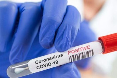 Koronavirusla bağlı son STATİSTİKA