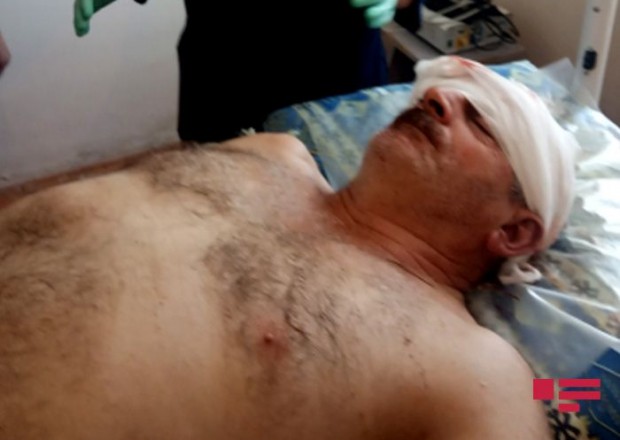 Ermənilərin Ağdam istiqamətində mərmi atəşi nəticəsində mülki şəxs yaralandı 