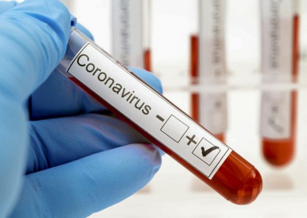 Gürcüstanda koronavirusa daha 360 nəfər yoluxdu 