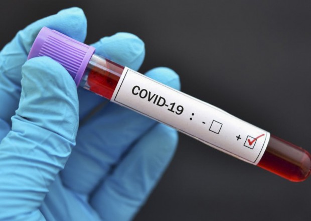 Rusiyada koronavirusdan ölənlərin sayı 205 mini ötdü 