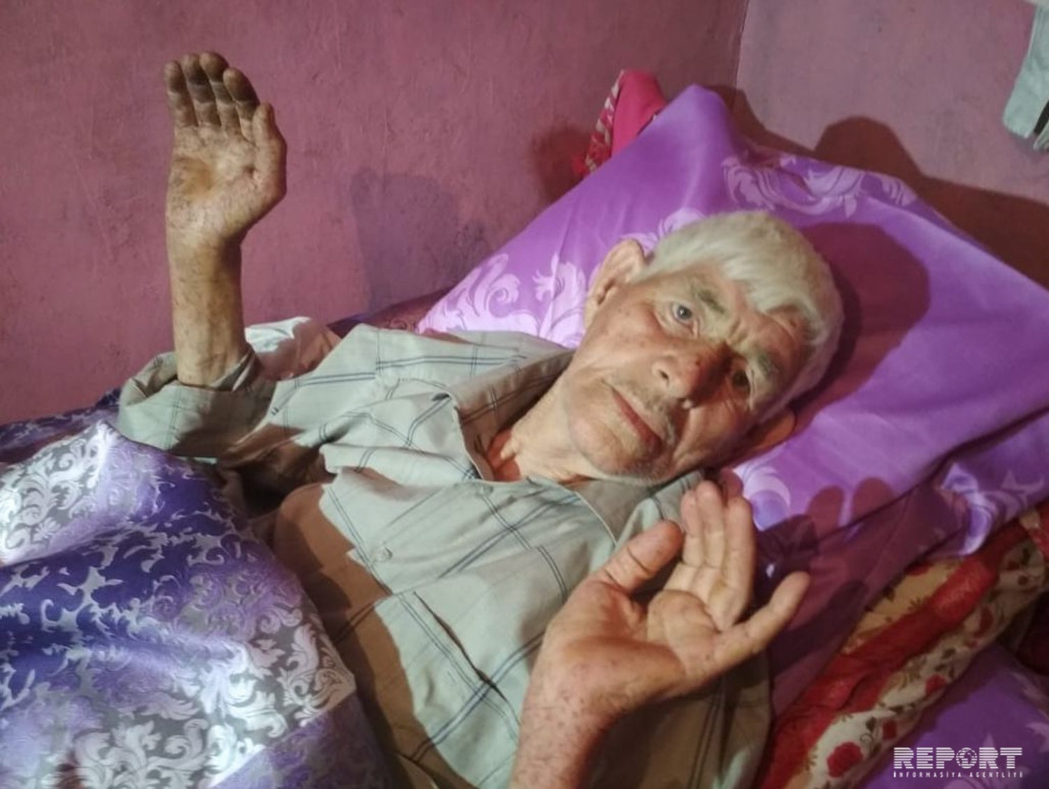 Bərdədə 80 yaşlı kişi kanala düşdü,    24 saatdan sonra xilas edildi (FOTO)