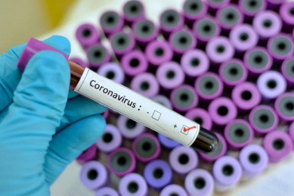 ÜST-nin əməkdaşları da koronavirusa yoluxdu 