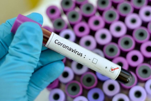 İtaliyada bir gündə 431 nəfər koronavirusdan ölüb 