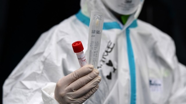Azərbaycanda daha 338 nəfərdə koronavirus aşkarlandı - 6 pasiyent öldü