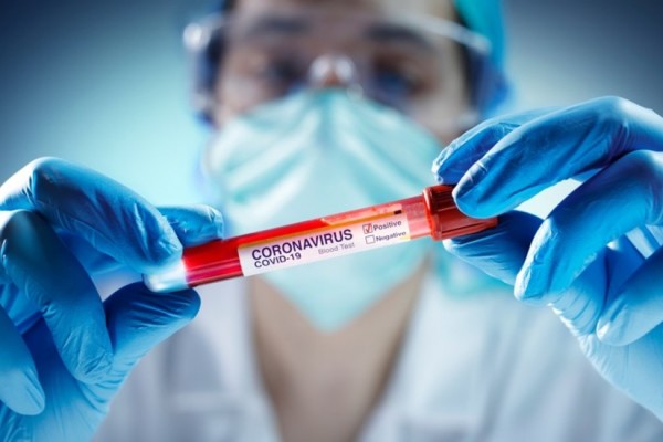 ABŞ-da son gündə 67 min insan koronavirusa yoluxdu