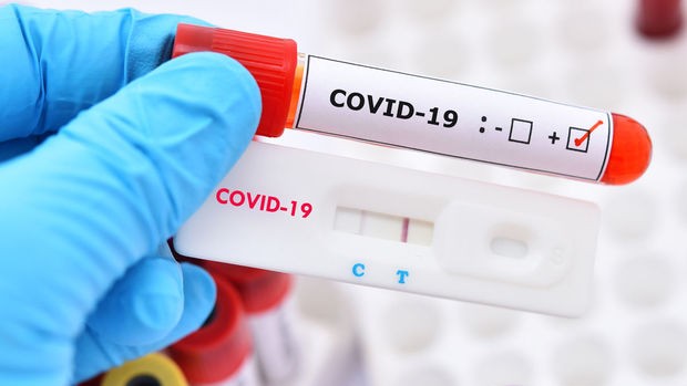 Rusiyada koronavirusdan ölənlərin sayı 197 mini ötdü 