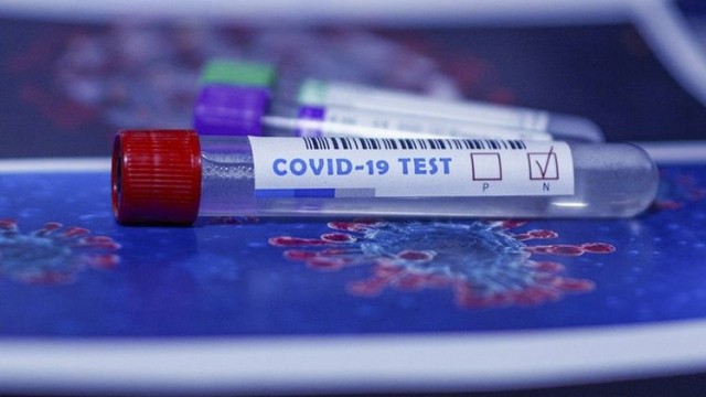 Azərbaycanda indiyədək aparılan koronavirus testlərinin sayı 1 milyonu keçib