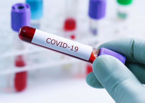 Son sutkada 420 mindən çox insan koronavirusa yoluxdu