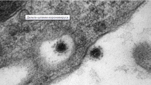 Koronavirusun delta ştammının fotosu dərc olundu