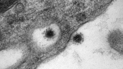 Koronavirusun delta ştammının fotosu dərc olundu