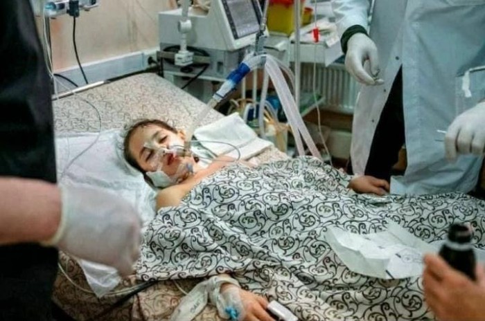 Rusların hücumları nəticəsində yaralanan uşaqlar - FOTOLAR
